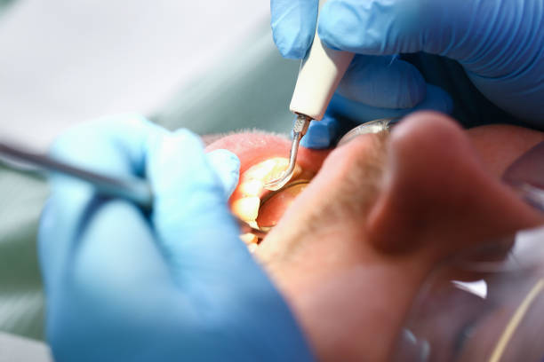 Best Emergency Broken Tooth Repair in Hermiston, OR